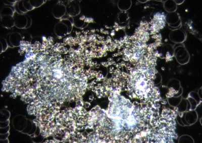 Dunkelfeldmikroskopie Helma Moog Harnsäurechristalle